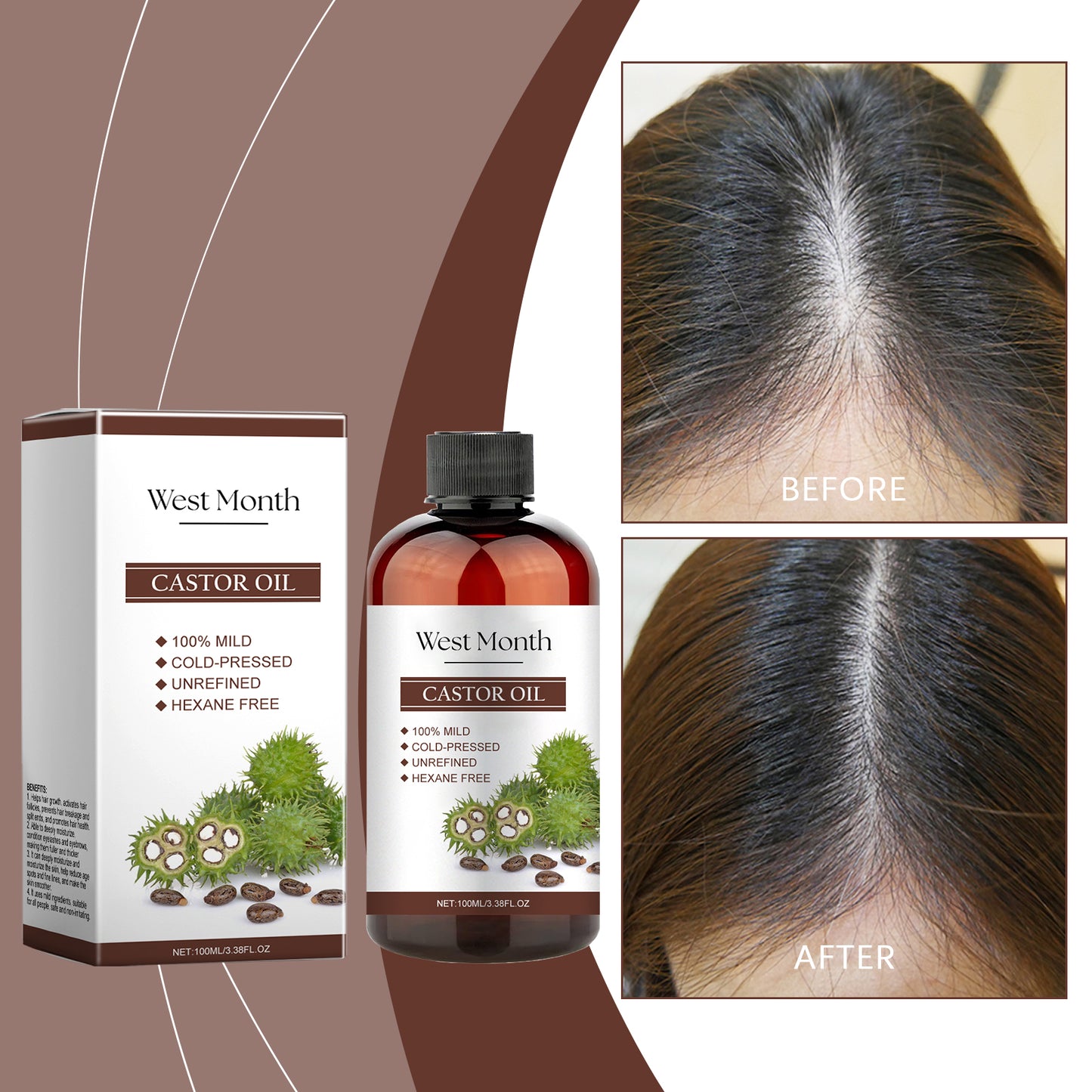 Organic Castor Oil for Hair Growth, Skin & Eyelashes – Jojoba & Vitamin E | 100ml